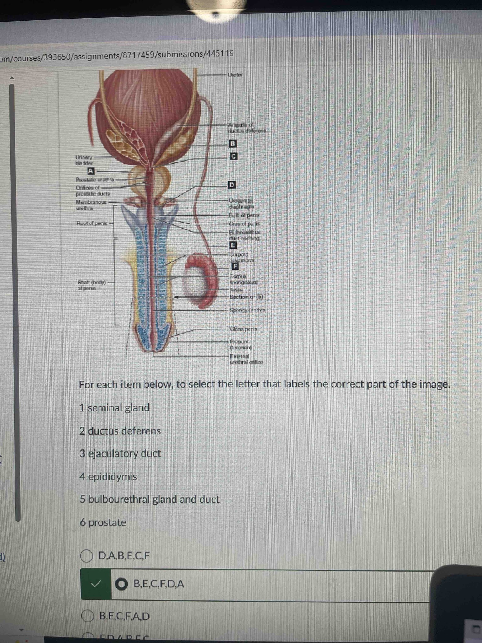 For each item below, to select the letter that labels the correct part of the image. 1 seminal gland, 2 ductus deferens, 3 ejaculatory duct, 4 epididymis, 5 bulbourethral gland and duct, 6 prostate
