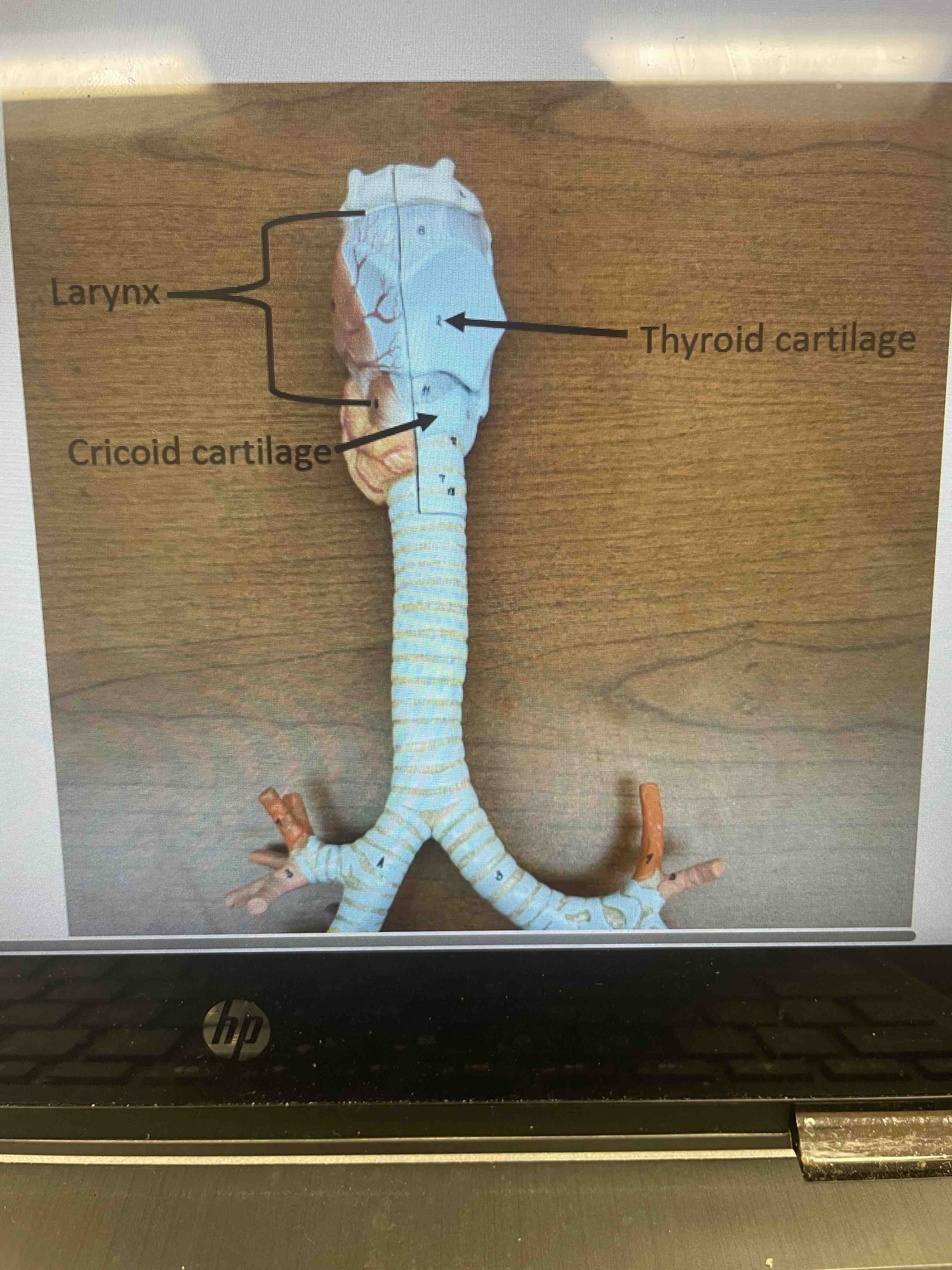 Identify the anatomical structures labeled in the provided anatomical model of the human respiratory system.