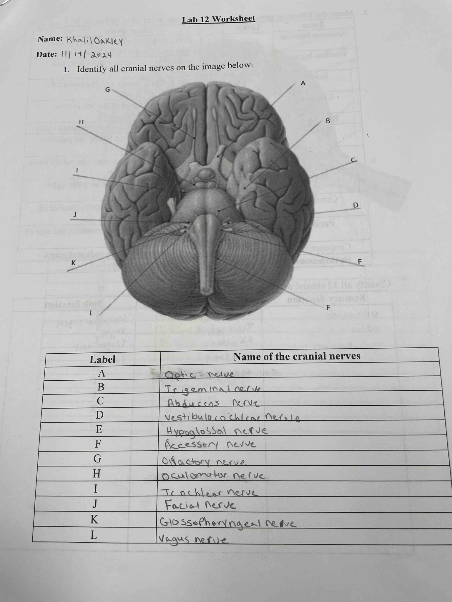 Identify all cranial nerves on the image below: