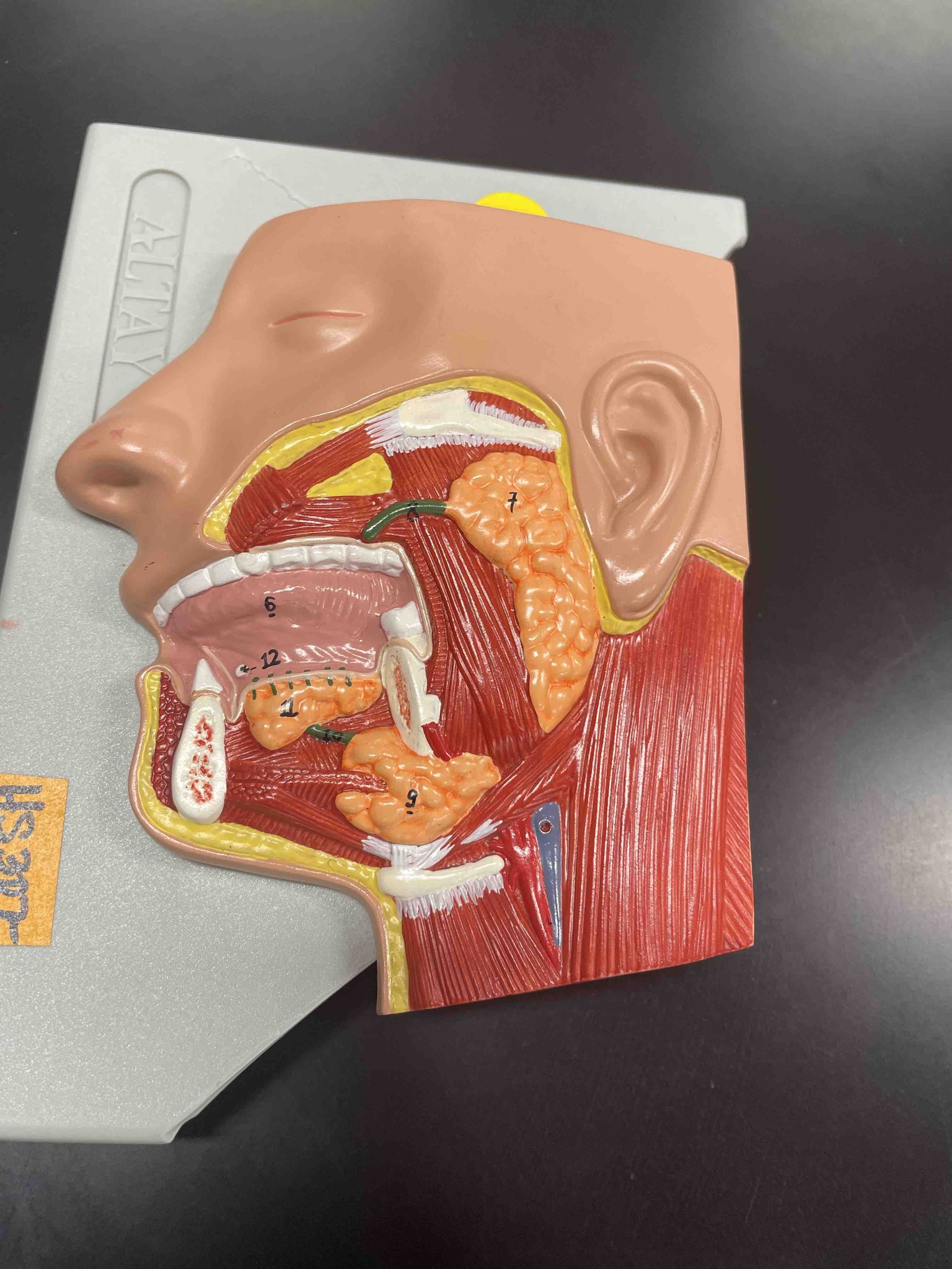 Identify the primary anatomical structures labeled in the provided model of the human head and neck, specifically focusing on the salivary glands and oral cavity.